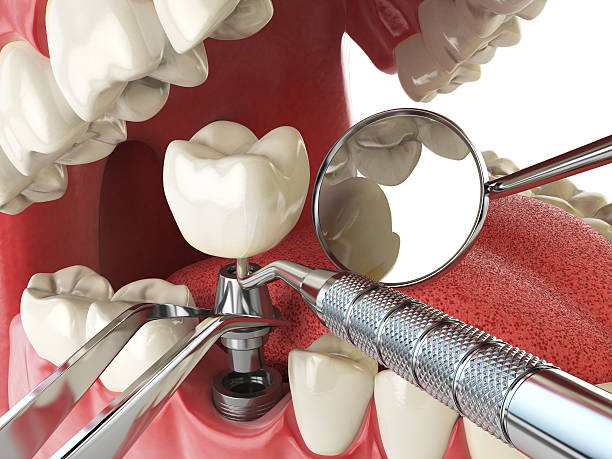Best Emergency Dental Surgery in Hawthorne, CA